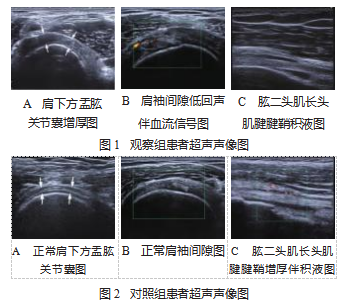 1A1AFBF3-1C49-46a3-B43B-B1A4A9EE809D.png