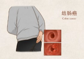 005XpTbZly1hp2ybulh3mj30u00u0mzt.jpg