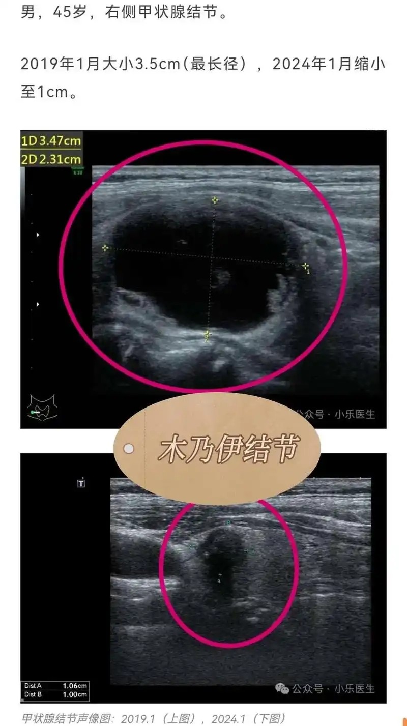38ceb3390a357d6e76b048daec0aa27.jpg