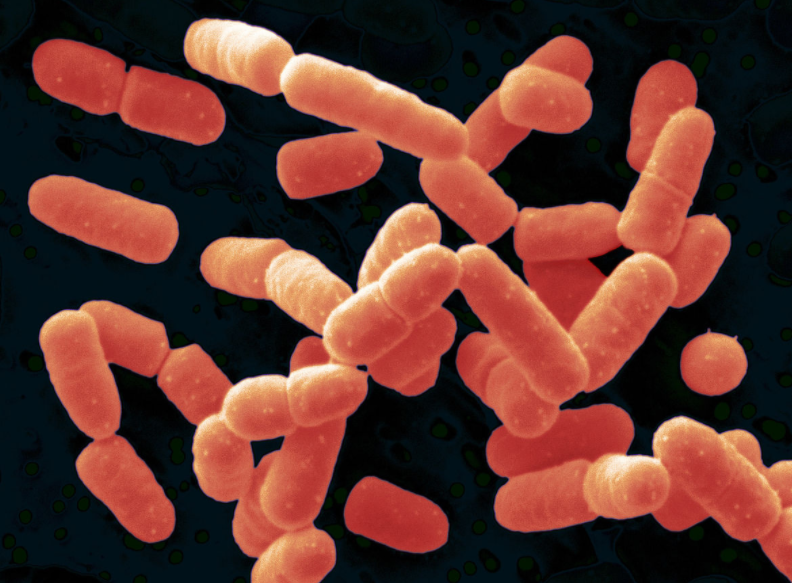 ed78edff469bfde497f29795d91d6f1e.png ed78edff469bfde497f29795d91d6f1e.png