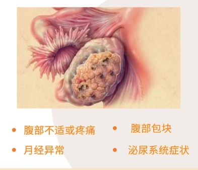 e7130b551636be2ad823fc20e42c7d82.png e7130b551636be2ad823fc20e42c7d82.png