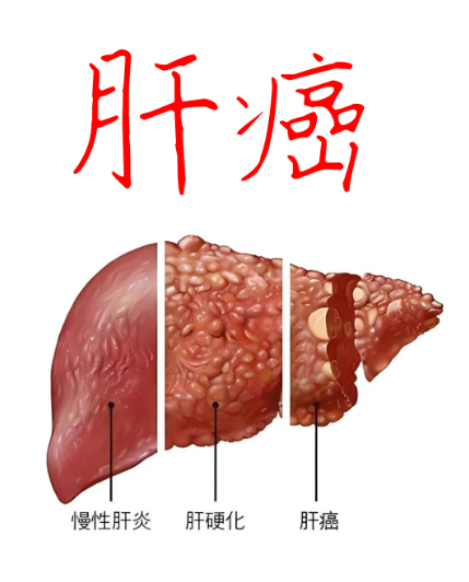 e0cd518a9909d51bd1b674bbf4494781.png